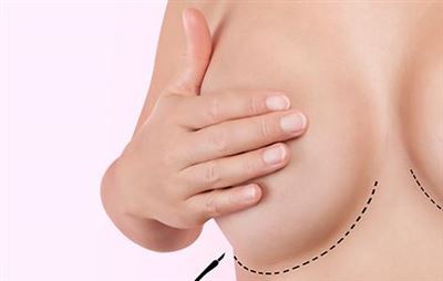 An Alternative Method in Breast Aesthetics: Breast Reduction