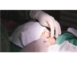 A patient who had lip fillers done at another clinic