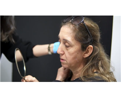 Our Mole Removal Patient
