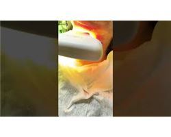 Neck Rejuvenation (Bblazer)