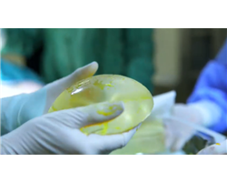 What is a prosthesis?