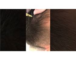 Saç Prp Tedavisi (Saç köklerini canlandırma, Saç dökülmesine)